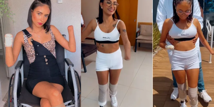 Meses após ter pernas e mãos amputadas, jovem comemora poder andar com próteses