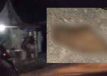 Vulgo ‘Churrasco’ fica ‘cotó’ ao ter a mão decepada no interior do AM após ser pego furtando; veja