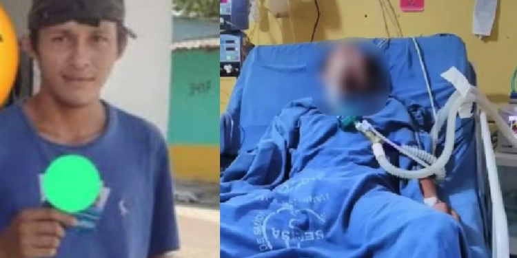 ‘Amigo da onça’ é suspeito de matar com pauladas na cabeça jovem em Parintins