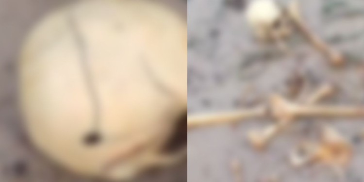 Cena forte: Esqueleto humano com tiro no crânio é encontrado perto da balsa Amarela na Manaus Moderna