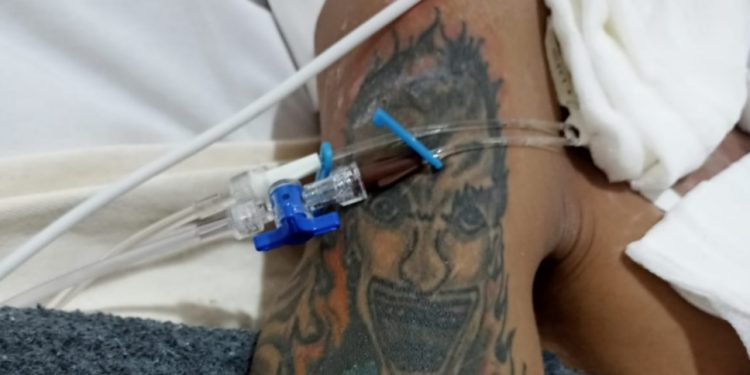 Imagem forte: com tatuagem de palhaço, homem agredido está há quase um mês abandonado no Platão