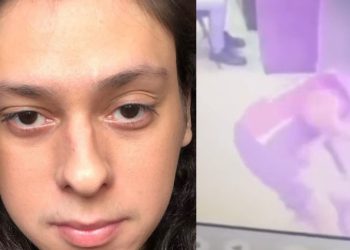 Espancado, ator Victor Meyniel consegue imagens do momento em que foi barbarizado