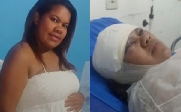 Mulher acorda com o rosto desfigurado no hospital e diz que foi vítima do marido: ‘ciúme da sogra’