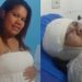 Mulher acorda com o rosto desfigurado no hospital e diz que foi vítima do marido: ‘ciúme da sogra’