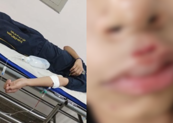 Mãe denuncia que filho foi atropelado e abandonado ferido em frente a hospital por motorista