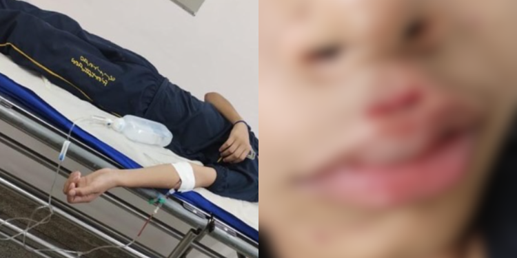 Mãe denuncia que filho foi atropelado e abandonado ferido em frente a hospital por motorista