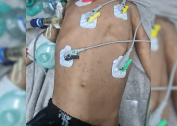 Tia é presa e marido foge após espancar criança e a deixarem em estado grave; imagens sensíveis