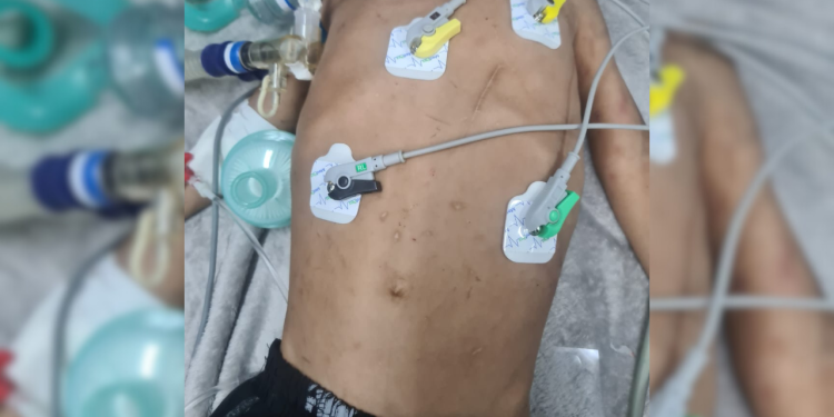 Tia é presa e marido foge após espancar criança e a deixarem em estado grave; imagens sensíveis