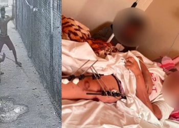 Vídeo: espancada no Santa Etelvina agoniza na cama, enquanto agressor está solto em Manaus