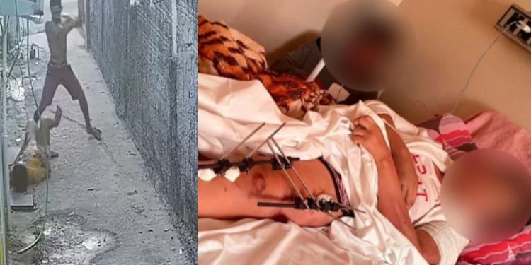 Vídeo: espancada no Santa Etelvina agoniza na cama, enquanto agressor está solto em Manaus