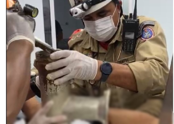 Trágico: funcionário perde a mão ao prendê-la no moedor de carne em supermercado de Manaus
