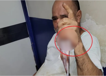 Pescador tem mão atravessada por ferrão de peixe durante pescaria