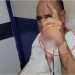 Pescador tem mão atravessada por ferrão de peixe durante pescaria