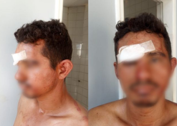 Homem tenta estuprar mulher ao invadir pousada em Manaus e acaba levando porrada