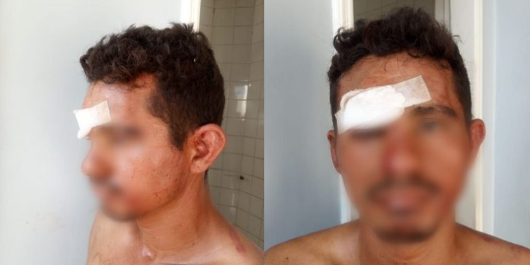Homem tenta estuprar mulher ao invadir pousada em Manaus e acaba levando porrada