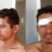 Homem tenta estuprar mulher ao invadir pousada em Manaus e acaba levando porrada