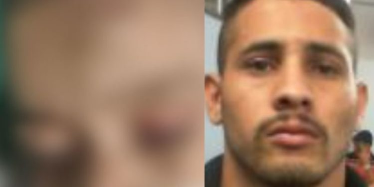 Tio suspeito de espancar e tentar matar sobrinho de 2 anos é detido em Manaus