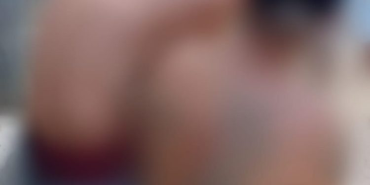Homem fica com faca cravada nas costas e espera chegada do Samu bem calminho