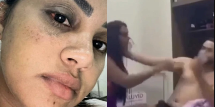 Vídeo: Andressinha, que meteu 30 chifres em Chicão dos Teclados, diz que foi agredida por novo namorado