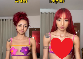 Veja o antes e depois de Ruivinha de Marte após 325 ml de silicone: ‘Tome peito agora’