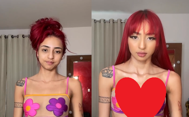 Veja o antes e depois de Ruivinha de Marte após 325 ml de silicone: ‘Tome peito agora’