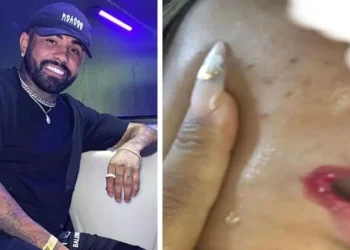 Jovem diz que jogador do Amazonas FC arrombou banheiro, a agrediu e até arrancou o cabelo