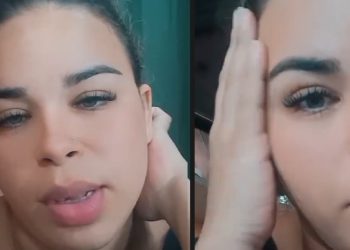 Candidata à musa em Manaus mostra ferimentos e acusa ex-namorado de agressão