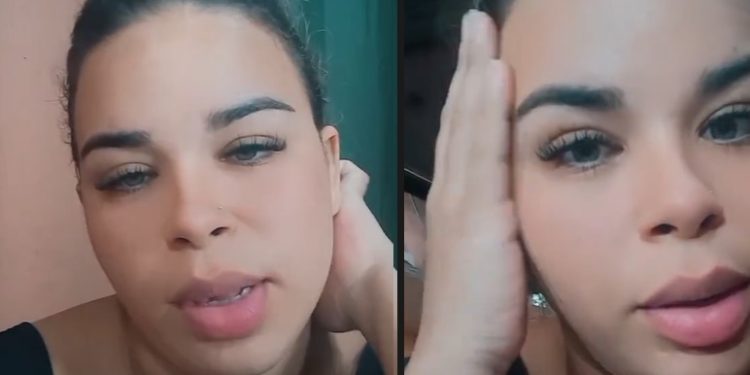 Candidata à musa em Manaus mostra ferimentos e acusa ex-namorado de agressão
