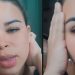 Candidata à musa em Manaus mostra ferimentos e acusa ex-namorado de agressão