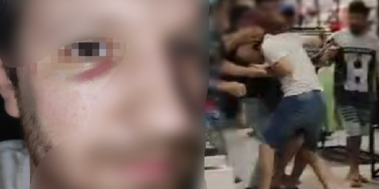 Em shopping de Manaus, pai é agredido por pedir prioridade na fila para a filha autista