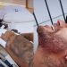 Neymar grita de dor ao fazer tratamento no joelho; vídeo