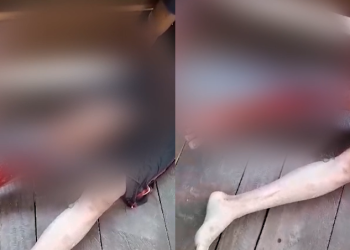 Vídeo: Jacaré morde jovem e quase arranca a perna dele no interior do Amazonas