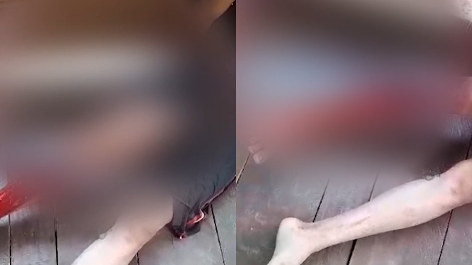 Vídeo: Jacaré morde jovem e quase arranca a perna dele no interior do Amazonas