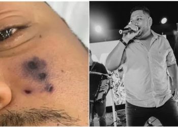 Cantor de forró é picado por aranha, passa mal e morre: ‘Começou a escurecer o rosto’