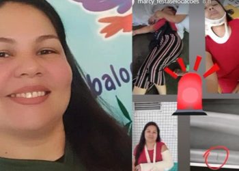 Empresária de Manaus relata drama após cair de escada e perder os sentidos: riscos’