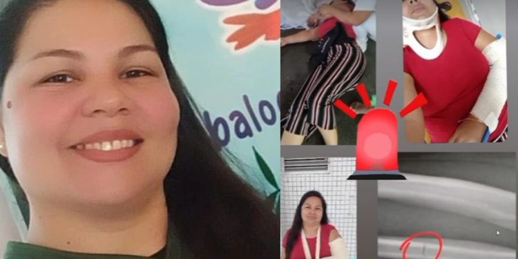 Empresária de Manaus relata drama após cair de escada e perder os sentidos: riscos’