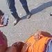 Vídeo forte: motoqueiro atingido por caminhão em Manaus tem perna quase “torada”