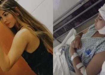 Após perder o couro cabeludo em acidente com kart, jovem chora de dor no hospital