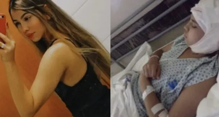 Após perder o couro cabeludo em acidente com kart, jovem chora de dor no hospital