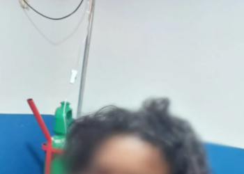 Imagem forte: Marido deixa a esposa deformada após arrancar nariz e furar olho dela