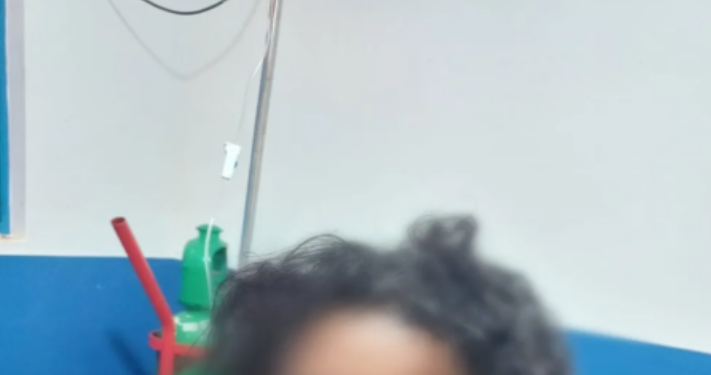 Imagem forte: Marido deixa a esposa deformada após arrancar nariz e furar olho dela