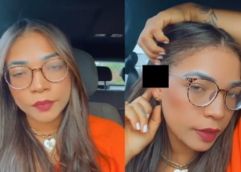 Vendedora tem parte da orelha arrancada por cliente que queria dar calote: ‘Vou passar por cirurgia’