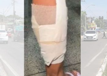 Diarista leva tiro na perna ao tentar evitar assalto na zona Sul