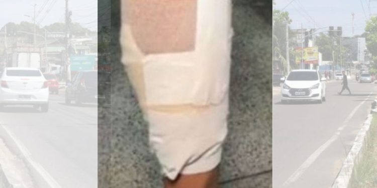 Diarista leva tiro na perna ao tentar evitar assalto na zona Sul