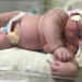 Lembra do bebê gigante de 7,3 kg de Parintins? Veja como ele está hoje, com 1 ano