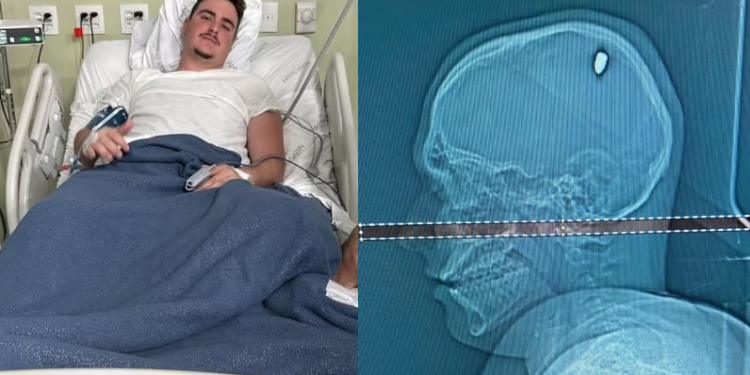 Após quatro dias, estudante descobre que foi vítima de bala perdida e levou tiro na cabeça
