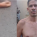 Vídeo: Morador que não quis ajudar traficantes do bairro tem a cabeça estour@da a tiros