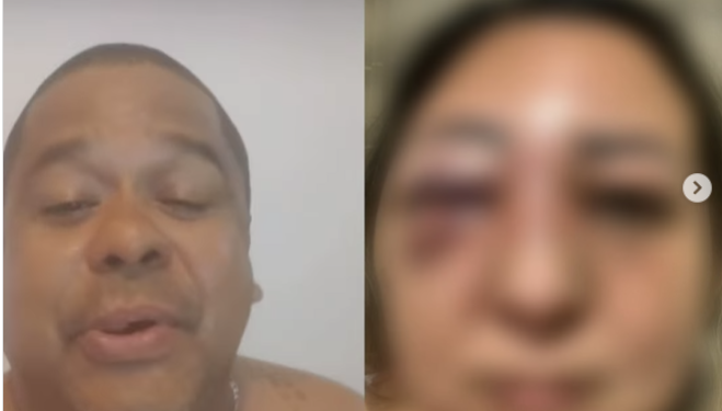 Advogado que é jiujiteiro ri de mulher agredida por casal em Manaus: ‘Pra deixar de ser lesa’