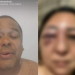 Advogado que é jiujiteiro ri de mulher agredida por casal em Manaus: ‘Pra deixar de ser lesa’