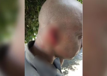PM tem parte da orelha arrancada por homem bêbado durante abordagem